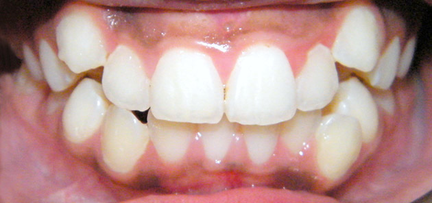 Before Treatment Image