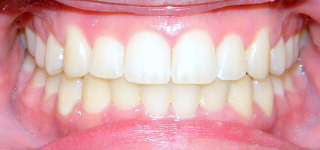After Treatment Image