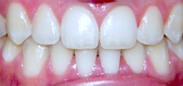 After Treatment Image